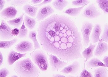 Study identifies five key factors that predict cancer patients’ response to immunotherapy