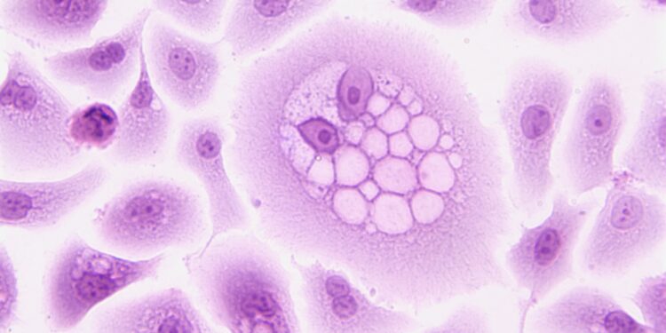 Study identifies five key factors that predict cancer patients’ response to immunotherapy