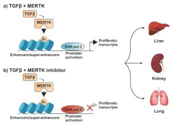 Study identifies promising target for drug therapy