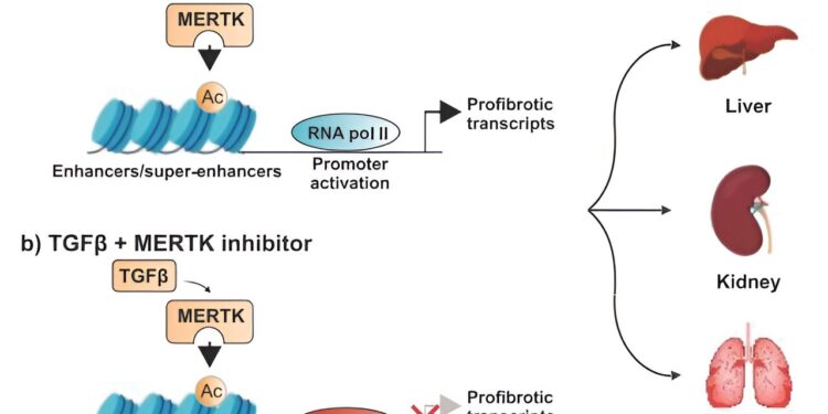 Study identifies promising target for drug therapy