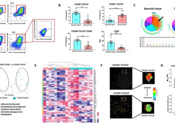 Study offers potential for early diagnosis and therapeutic intervention for rheumatoid arthritis