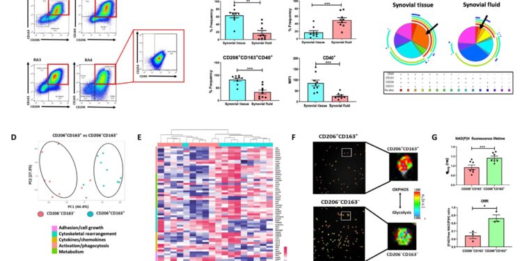 Study offers potential for early diagnosis and therapeutic intervention for rheumatoid arthritis