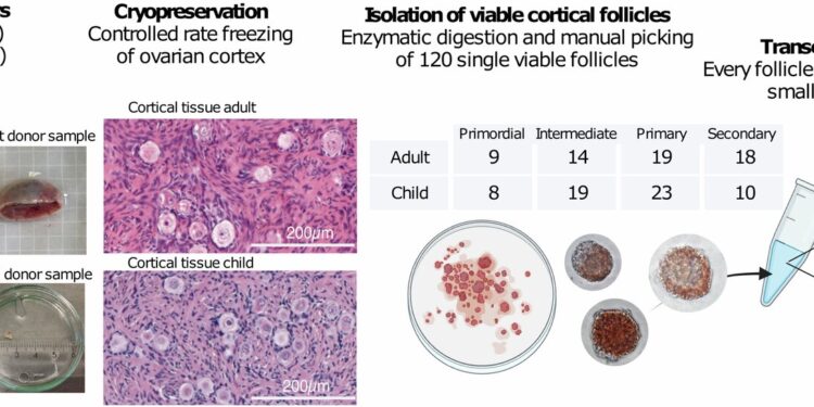 Study provides new insights into ovarian follicle development and previously unknown variations
