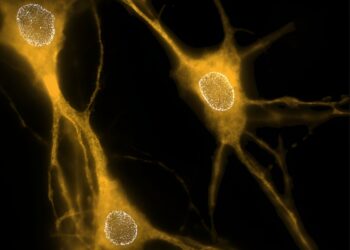 Study reveals how key protein affects neuron structure