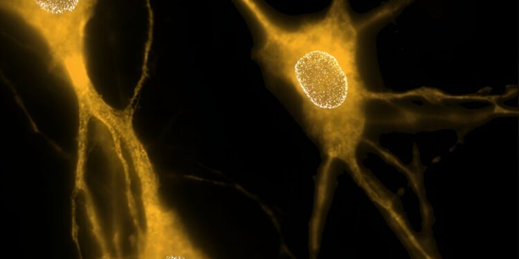 Study reveals how key protein affects neuron structure