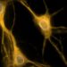 Study reveals how key protein affects neuron structure