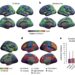 Study suggests attention networks promote changes in cortical organization and cognition during childhood