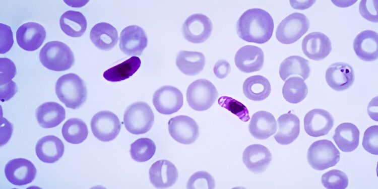 Synthetic compound shows promise against susceptible and drug-resistant strains of human malaria parasites