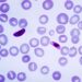 Synthetic compound shows promise against susceptible and drug-resistant strains of human malaria parasites
