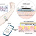 Team develops next-generation wearable continuous glucose monitoring system for diabetes management