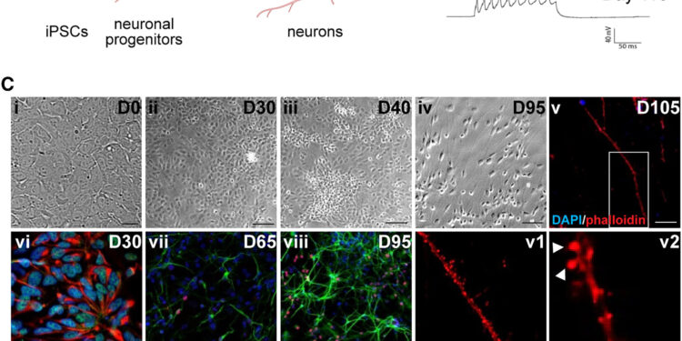 Treatments that maintain healthy synapses may help prevent and alleviate symptoms of prion disease