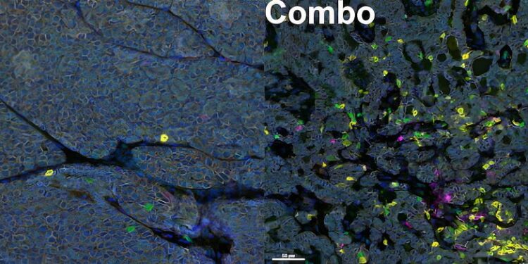 Two-pronged strategy restores sensitivity to immunotherapy