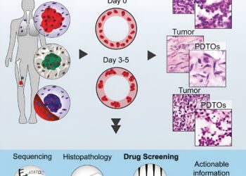 Unlocking the potential of patient-derived organoids for personalized sarcoma treatment