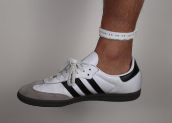 Wearable microfluidic wristband can measure sweat biochemistry at rest or during exercise