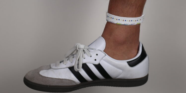 Wearable microfluidic wristband can measure sweat biochemistry at rest or during exercise