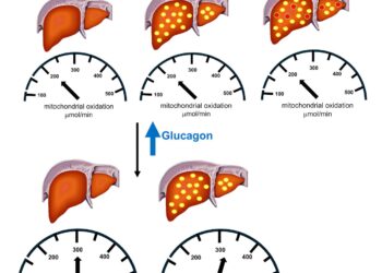 Weight-loss drugs may help fight fatty liver disease
