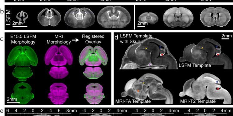 3D mouse brain atlas provides a more dynamic 360-degree picture of development