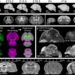 3D mouse brain atlas provides a more dynamic 360-degree picture of development