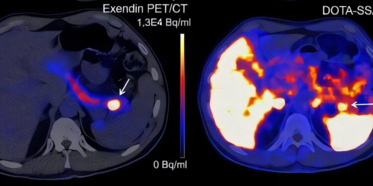 Analysis based on lizard saliva detects rare tumor