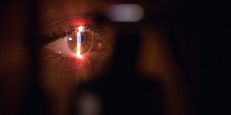 Black adults disproportionately affected as glaucoma reaches 4.22 million in US