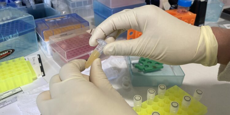 Blood test study may help improve performance and reduce side effects of mRNA vaccines