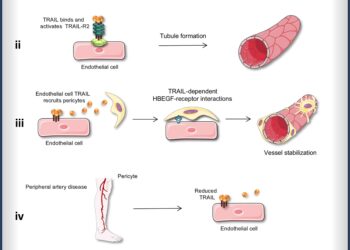 Cancer drug could be used to save limbs of patients with peripheral artery disease, preclinical study suggests