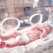 Clonidine monotherapy is as effective as morphine in treating neonatal opioid withdrawal, study finds
