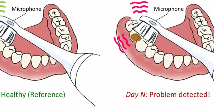 Exploring Dental Health Detection Using a Sonic Toothbrush