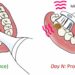 Exploring Dental Health Detection Using a Sonic Toothbrush