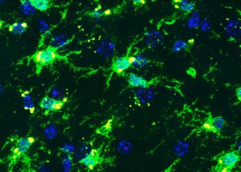 Genetic variants linked to Alzheimer’s trigger brain inflammation in women, preclinical study finds