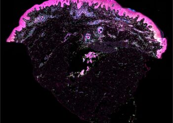 Human skin map gives ‘recipe’ for building skin and could help prevent scarring
