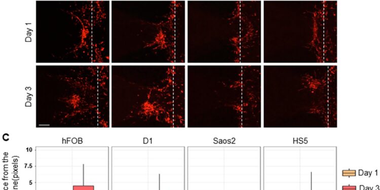 In vitro model helps show why breast cancer spreads to bones