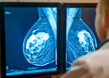 Increase in the number of cases of breast cancer among women under 50