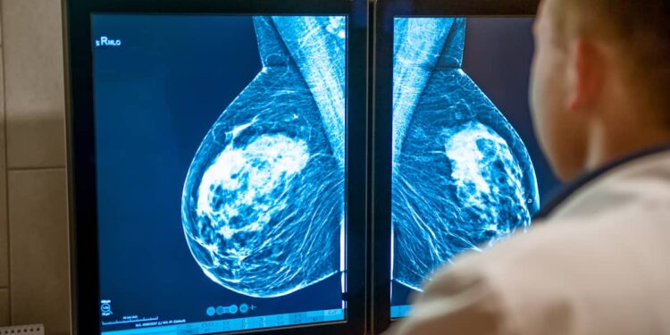 Increase in the number of cases of breast cancer among women under 50