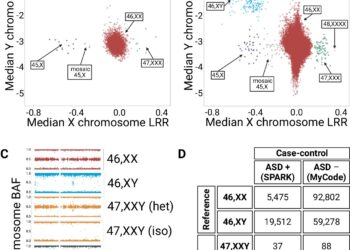 Increased risk of autism linked to Y chromosome, study finds