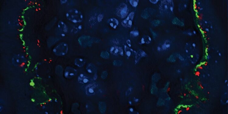 Inducing a gene that informs cell signaling could stop diabetic kidney disease, study suggests