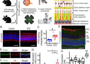 New knowledge about diabetes-related vision problems to inform treatment and prevention