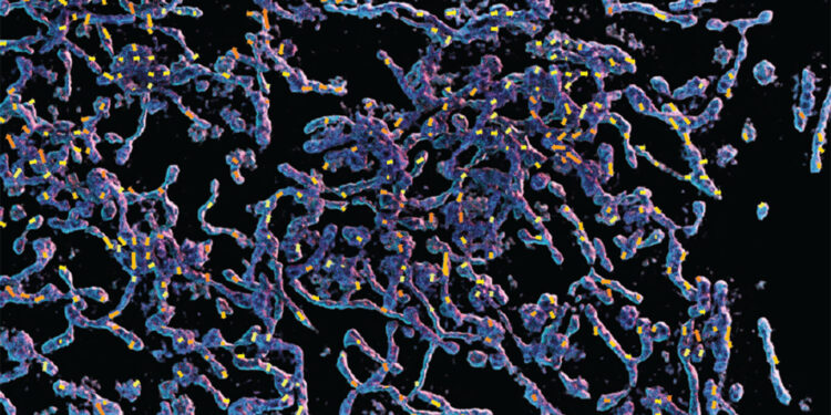 New tool removes motion artifacts