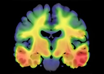 Newly discovered genetic marker could pave the way for future treatments for Alzheimer’s disease