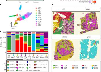 Pancreatic cancer tumor map reveals notable differences between primary and metastatic disease