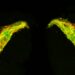 Promising Alzheimer’s drug candidate prevents tau protein buildup in lab and fruit fly studies