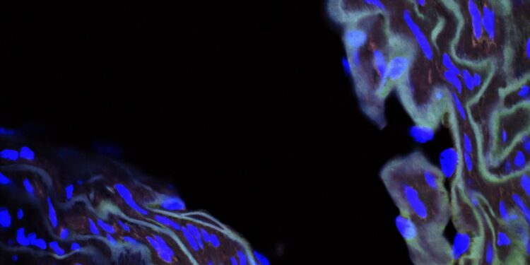 Protein discovery could pave way for improved treatment of premature aging disease