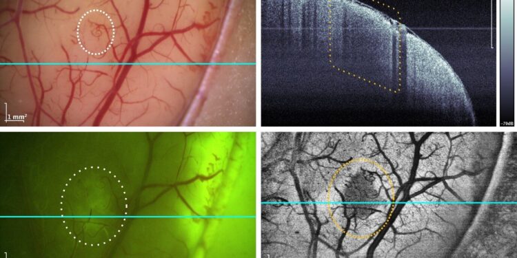 Researchers integrate rapid optical coherence tomography system with neurosurgical microscope