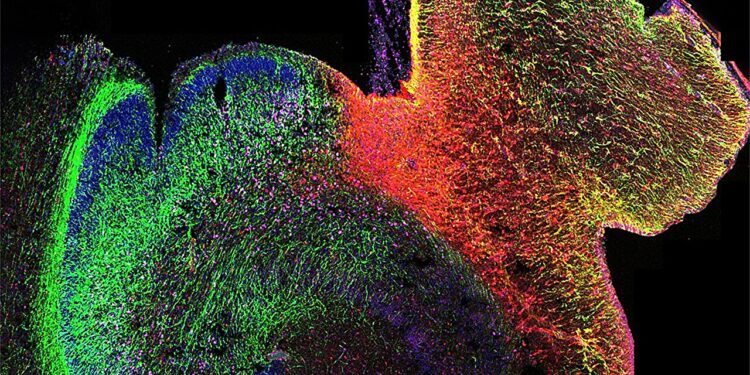 Scientists create first map of DNA modification in developing human brain