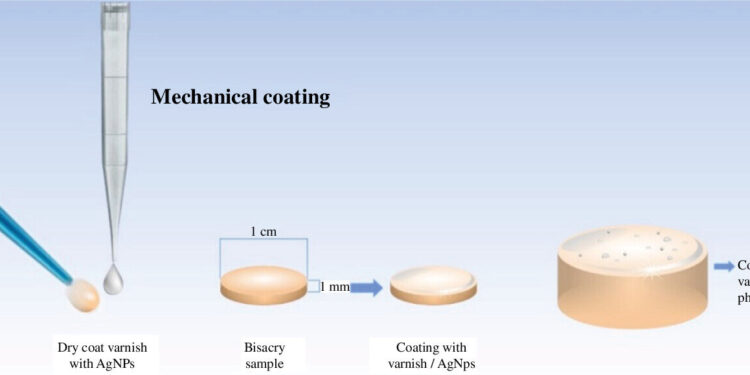Scientists design self-hygienic resin based on silver nanoparticles for dental applications