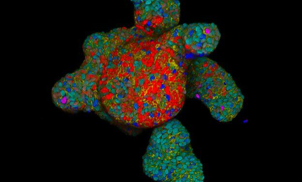 Scientists develop tools to identify gut nutrient sensors