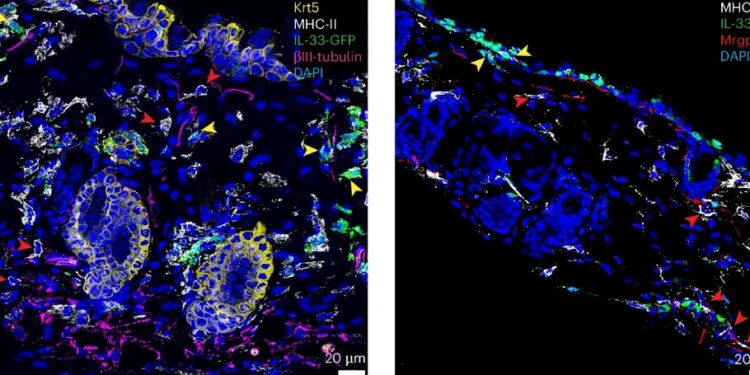 Sensory immunity study reveals how parasitic worms found a way to escape mammals’ need to scratch their itch