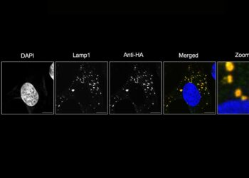 Solving a 50-year-old mystery could lead to treatments for neurodegenerative diseases