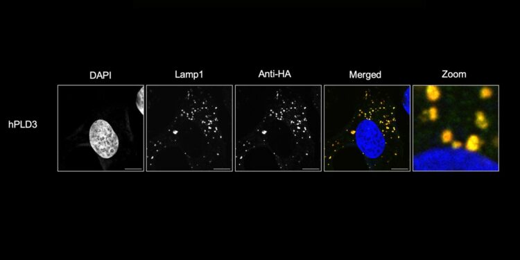 Solving a 50-year-old mystery could lead to treatments for neurodegenerative diseases