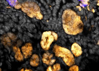 Stem cell studies detail how progenitor cells self-renew, differentiate, and aggregate into early kidney structures